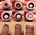Stretching the foreskin opening with flesh tunnel of different diameters